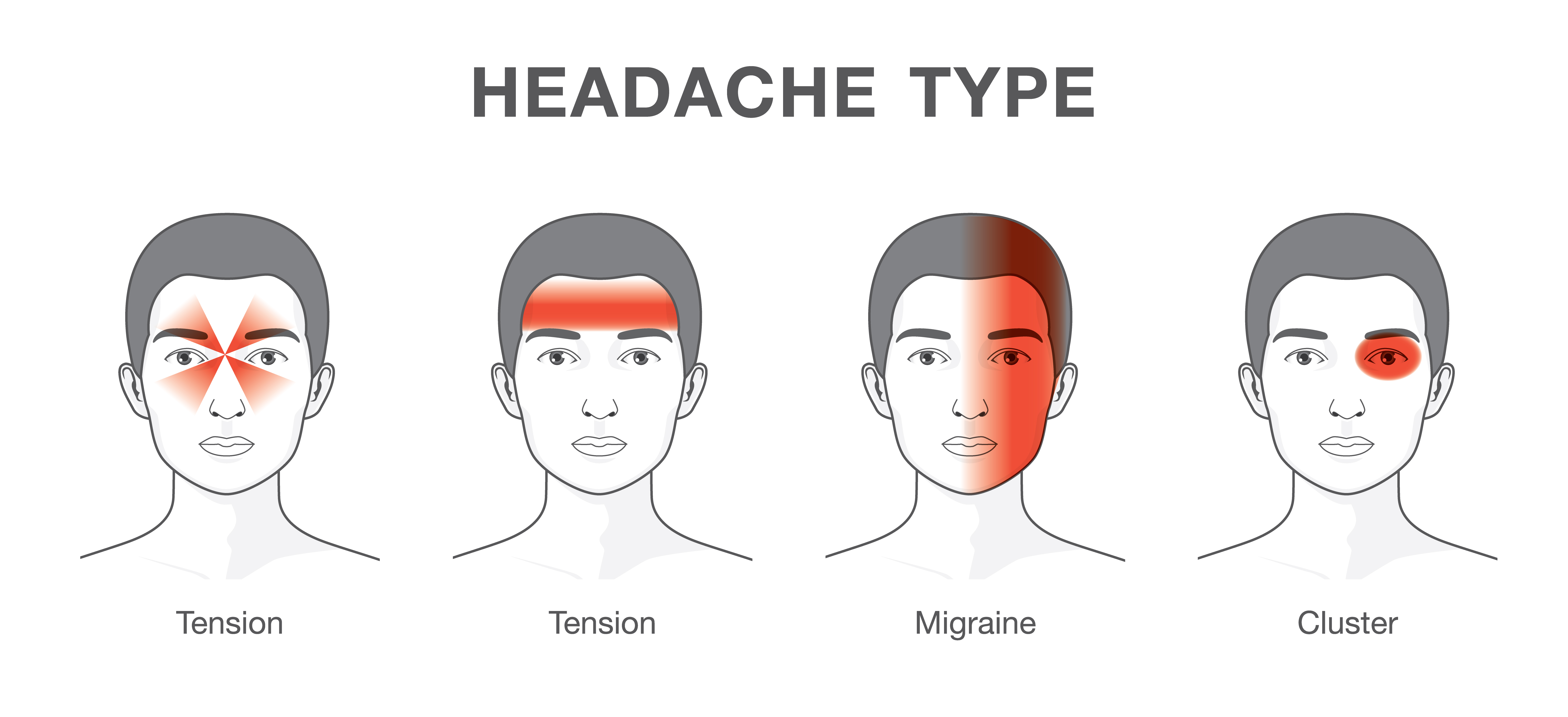 Druhy chronickej bolesti hlavy
