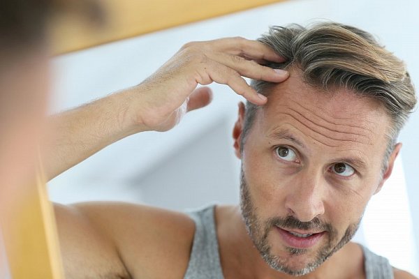 Príčiny padania vlasov a tipy ako ho zmierniť